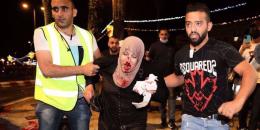 Siyonizm vahşice saldırıyor: Filistin’e destek için normalleşmeyi reddet!