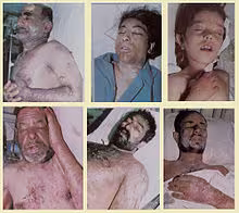 iran-irak_kimyasal.jpg